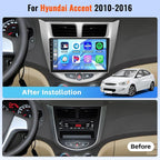 Android 15 Car Stereo for Hyundai Accent 2010-2016 - Image 2